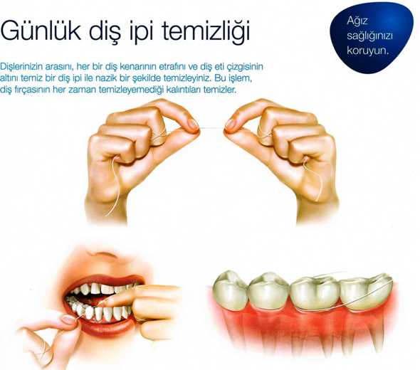 diş ipi